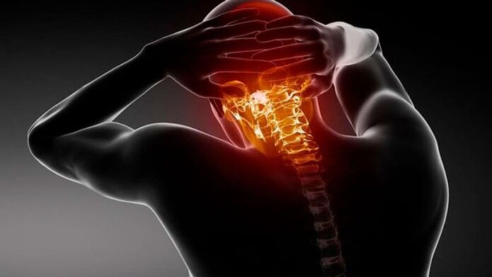 sakit ng ulo na may servikal osteochondrosis