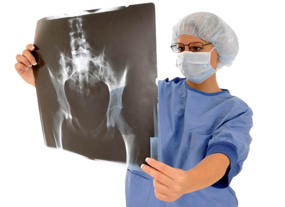 Ang X-ray ng hip joint ay makakatulong sa doktor na matukoy ang sanhi ng sakit